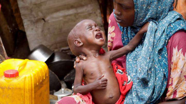 В Судане – детский голод