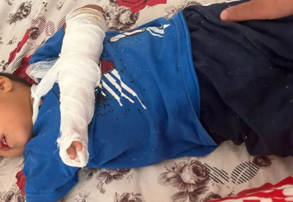 Мальчику раздавило палец в детском саду Мангистау