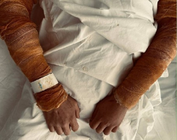 Поход в баню закончился для двух казанцев ожогами паром